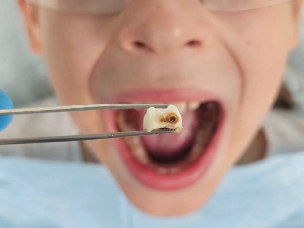 Best Pediatric Emergency Dentist in Tarboro, NC